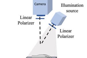 BostonU SPIE camera reveals postprandial lipid levels